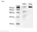 Fig. 41 - Nucleic acid products and methods of administration thereof