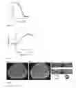 Fig. 02 - Manganese-based chelate conjugates for molecular MR imaging
