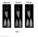 Fig. 07 - Compositions and methods for treatment and imaging using nanoparticles
