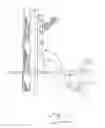 Fig. 08 - TRANSCUTANEOUS DEVICE FOR REMOVAL OF FLUID FROM A BODY
