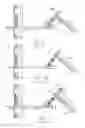 Fig. 10 - TRANSCUTANEOUS DEVICE FOR REMOVAL OF FLUID FROM A BODY