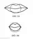 Fig. 07 - Lip-enhancement device and method