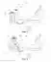 Fig. 03 - Heart failure recovery device and method of treatment