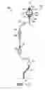 Fig. 02 - Infusion pump with elongation sensor