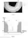 Fig. 03 - SURFACE HARDENED INJECTION NEEDLE AND METHOD OF PRODUCING SUCH
