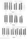 Fig. 04 - SURFACE HARDENED INJECTION NEEDLE AND METHOD OF PRODUCING SUCH