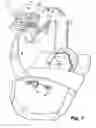 Fig. 02 - Multipath filter assembly with integrated gaseous seal for multimodal surgical gas delivery system