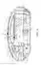 Fig. 04 - Therapeutic vaporizer
