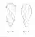 Fig. 09 - VASCULAR CATHETER