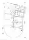 Fig. 02 - Device with open cutout design for securement and position verification of medical catheters