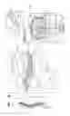 Fig. 02 - Disc therapy
