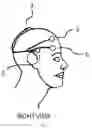 Fig. 08 - TRANSCRANIAL ELECTRICAL STIMULATION DEVICE HAVING MULTIPURPOSE ELECTRODES