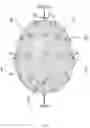 Fig. 09 - TRANSCRANIAL ELECTRICAL STIMULATION DEVICE HAVING MULTIPURPOSE ELECTRODES