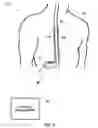 Fig. 02 - User interface for identifying midlines of spinal cord