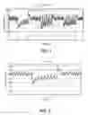 Fig. 02 - Methods and systems for lowering blood pressure through reduction of ventricle filling