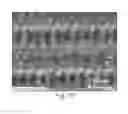 Fig. 06 - Methods of making plastic-metal junctions via laser