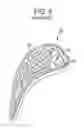Fig. 06 - Additively manufactured integrated casting core structure with ceramic shell