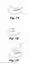Fig. 08 - COALESCING FROTHY FLUIDS