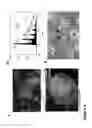 Fig. 15 - LARGE SCALE GENERATION OF FUNCTIONAL MEGAKARYOCYTES AND PLATELETS FROM HUMAN EMBRYONIC STEM CELLS UNDER STROMAL-FREE CONDITIONS