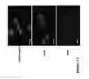 Fig. 22 - LARGE SCALE GENERATION OF FUNCTIONAL MEGAKARYOCYTES AND PLATELETS FROM HUMAN EMBRYONIC STEM CELLS UNDER STROMAL-FREE CONDITIONS