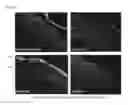 Fig. 09 - PROMOTERS, EXPRESSION CASSETTES, VECTORS, KITS, AND METHODS FOR THE TREATMENT OF ACHROMATOPSIA AND OTHER DISEASES