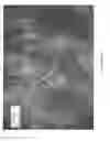 Fig. 366 - Silk performance apparel and products and methods of preparing the same