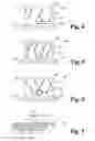 Fig. 05 - Regulating device for an internal combustion engine