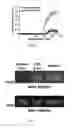 Fig. 04 - Methods of detecting and reducing cancer cell central nervous system colonization