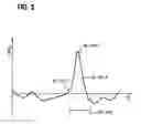 Fig. 04 - Method for classifying driver movements