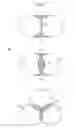 Fig. 05 - ENDOSCOPE APPARATUS, ENDOSCOPE SYSTEM AND SURGICAL SYSTEM INCLUDING THE SAME