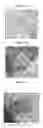 Fig. 02 - Small mobile stem cells (SMS) and uses thereof