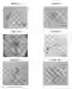 Fig. 05 - Small mobile stem cells (SMS) and uses thereof
