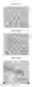 Fig. 06 - Small mobile stem cells (SMS) and uses thereof