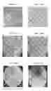 Fig. 17 - Small mobile stem cells (SMS) and uses thereof
