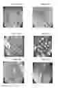 Fig. 18 - Small mobile stem cells (SMS) and uses thereof