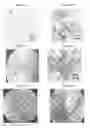 Fig. 19 - Small mobile stem cells (SMS) and uses thereof