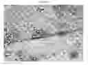 Fig. 22 - Small mobile stem cells (SMS) and uses thereof