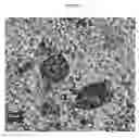 Fig. 31 - Small mobile stem cells (SMS) and uses thereof