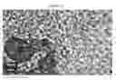 Fig. 40 - Small mobile stem cells (SMS) and uses thereof
