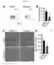 Fig. 09 - Human pluripotent stem cell-based screening for smooth muscle cell differentiation and disease