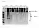 Fig. 02 - Method of RNA in vitro transcription using a buffer containing a dicarboxylic acid or tricarboxylic acid or a salt thereof