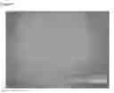 Fig. 03 - Collection device and material