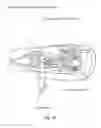 Fig. 41 - Eye mounted intraocular displays and systems
