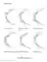 Fig. 67 - Eye mounted intraocular displays and systems
