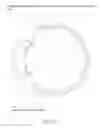 Fig. 76 - Eye mounted intraocular displays and systems