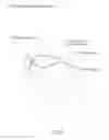 Fig. 77 - Eye mounted intraocular displays and systems