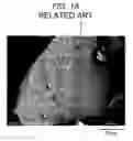 Fig. 02 - DUST CORE