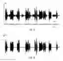 Fig. 05 - Headset with reduction of ambient noise