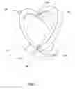 Fig. 02 - Foldable Ring