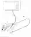 Fig. 02 - Endoscope bending section control mechanism